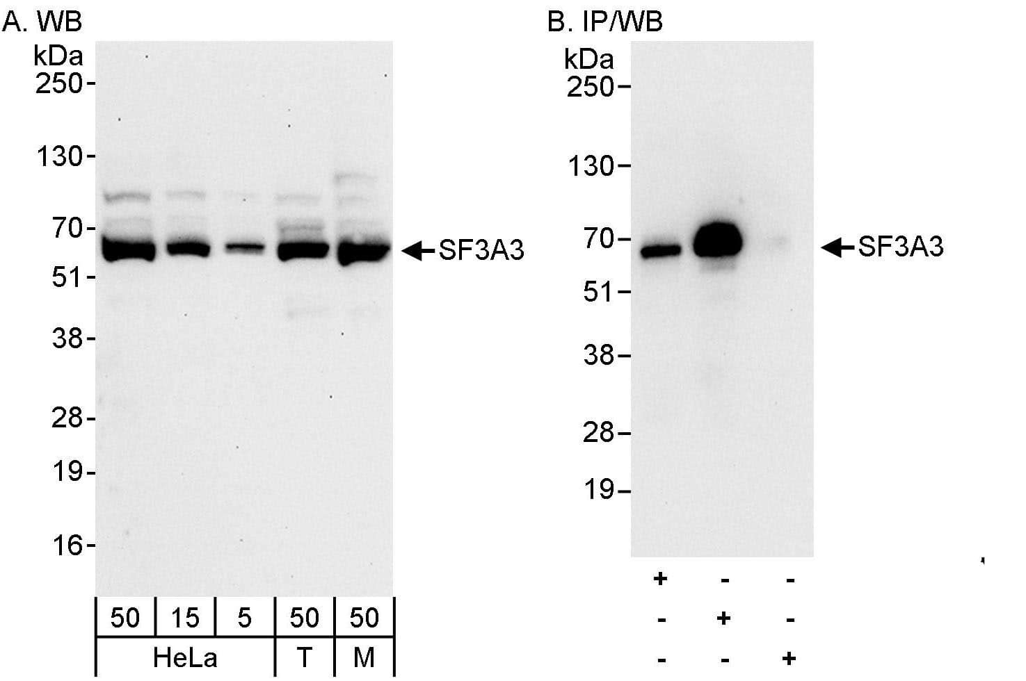 Western Blot:[NBP3-30293]-Detection of human and mouse SF3A3 by western blot and immunoprecipitation. Samples: Whole cell lysate from HeLa , HEK293T , and mouse NIH 3T3 cells. Antibodies: Affinity purified rabbit anti-SF3A3 antibody used for WB at 0. 04 µg/ml and 0. 4 µg/ml and used for IP at 3 µg/mg lysate. SF3A3 was more efficiently immunoprecipitated by rabbit anti-SF3A3 antibody , which recognizes a downstream epitope. Detection: Chemiluminescence with exposure times of 30 seconds and 10 seconds.