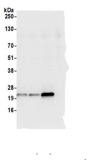 Immunoprecipitation:LMP7/PSMB8 AntibodyNBP3-30294] -Detection of human PSMB8 by western blot of immunoprecipitates. Samples: Whole cell lysate (0.5 or 1.0 mg per IP reaction; 20% of IP loaded) from Jurkat cells prepared using NETN lysis buffer. Antibodies: Affinity purified rabbit anti-PSMB8 antibody NBP3-30294 (lot NBP3-30294-1) used for IP at 6 µg per reaction. PSMB8 was also immunoprecipitated by rabbit anti-PSMB8 antibodies A305-229A and BL20532. For blotting immunoprecipitated PSMB8, NBP3-30294 was used at 1 µg/ml. Detection: Chemiluminescence with an exposure time of 3 seconds.