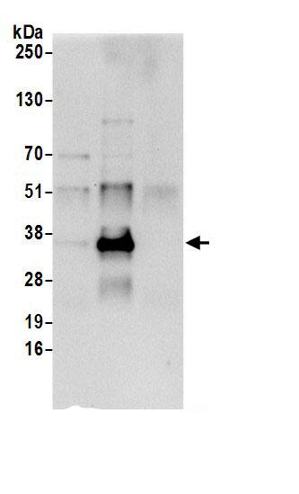 Immunoprecipitation:Dimethylarginine Dimethylaminohydrolase 1/DDAH1 AntibodyNBP3-30296] -Detection of human DDAH1 by western blot of immunoprecipitates. Samples: Whole cell lysate (0.5 or 1.0 mg per IP reaction; 20% of IP loaded) from 293T cells prepared using NETN lysis buffer. Antibodies: Affinity purified rabbit anti-DDAH1 antibody NBP3-30296 (lot NBP3-30296-1) used for IP at 6 µg per reaction. DDAH1 was also immunoprecipitated by rabbit anti-DDAH1 antibody BL21178. For blotting immunoprecipitated DDAH1, NBP3-30296 was used at 1 µg/ml. Detection: Chemiluminescence with an exposure time of 10 seconds.
