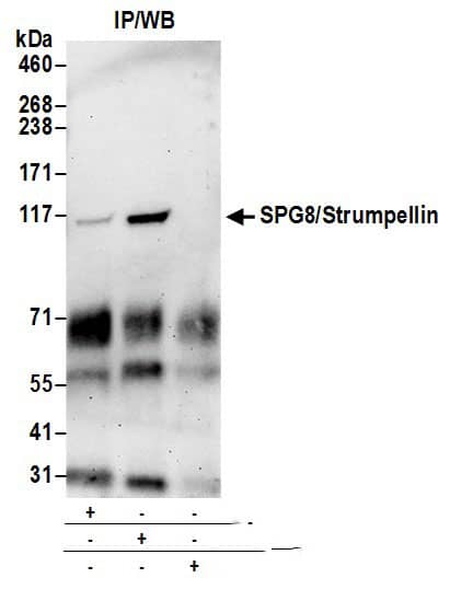 Immunoprecipitation:[NBP3-30297]-Detection of human SPG8/Strumpellin by western blot of immunoprecipitates. Samples: Whole cell lysate from 293T cells prepared using NETN lysis buffer. Antibodies: Affinity purified rabbit anti-SPG8/Strumpellin antibody used for IP at 6 µg per reaction. SPG8/Strumpellin was inefficiently immunoprecipitated by rabbit anti-SPG8/Strumpellin antibody. For blotting immunoprecipitated SPG8/Strumpellin, was used at 0. 4 µg/ml. Detection: Chemiluminescence with an exposure time of 3 minutes.