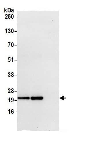 Immunoprecipitation:ATP5H AntibodyNBP3-30298] -Detection of human ATP5H by western blot of immunoprecipitates. Samples: Whole cell lysate (0.5 or 1.0 mg per IP reaction; 20% of IP loaded) from 293T cells prepared using NETN lysis buffer. Antibodies: Affinity purified rabbit anti-ATP5H antibody NBP3-30298 (lot NBP3-30298-1) used for IP at 6 µg per reaction. ATP5H was also immunoprecipitated by rabbit anti-ATP5H.. For blotting immunoprecipitated ATP5H, NBP3-30298 was used at 0.4 µg/ml. Detection: Chemiluminescence with an exposure time of 10 seconds.
