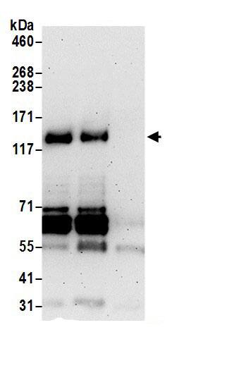 Immunoprecipitation:FHOD1 AntibodyNBP3-30299] -Detection of human FHOD1 by western blot of immunoprecipitates. Samples: Whole cell lysate (0.5 or 1.0 mg per IP reaction; 20% of IP loaded) from 293T cells prepared using NETN lysis buffer. Antibodies: Affinity purified rabbit anti-FHOD1 antibody NBP3-30299 (lot NBP3-30299-1) used for IP at 6 µg per reaction. FHOD1 was also immunoprecipitated by rabbit anti-FHOD1.. For blotting immunoprecipitated FHOD1, NBP3-30299 was used at 1 µg/ml. Detection: Chemiluminescence with an exposure time of 3 minutes.