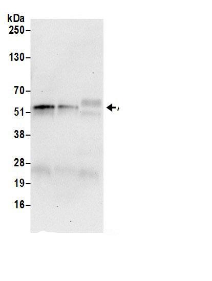 Immunoprecipitation:DARS AntibodyNBP3-30300] -Detection of human Aspartyl-tRNA Synthetase by western blot of immunoprecipitates. Samples: Whole cell lysate (0.5 or 1.0 mg per IP reaction; 20% of IP loaded) from 293T cells prepared using NETN lysis buffer. Antibodies: Affinity purified rabbit anti-Aspartyl-tRNA Synthetase antibody NBP3-30300 (lot NBP3-30300-1) used for IP at 6 µg per reaction. Aspartyl-tRNA Synthetase was also immunoprecipitated by rabbit anti-Aspartyl-tRNA Synthetase antibody for blotting immunoprecipitated Aspartyl-tRNA Synthetase, NBP3-30300 was used at 0.4 µg/ml. Detection: Chemiluminescence with an exposure time of 30 seconds.