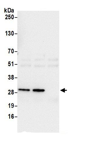 Immunoprecipitation:GEMIN2 AntibodyNBP3-30301] -Detection of human GEMIN2 by western blot of immunoprecipitates. Samples: Whole cell lysate (0.5 or 1.0 mg per IP reaction; 20% of IP loaded) from 293T cells prepared using NETN lysis buffer. Antibodies: Affinity purified rabbit anti-GEMIN2 antibody NBP3-30301 (lot NBP3-30301-1) used for IP at 6 µg per reaction. GEMIN2 was also immunoprecipitated by rabbit anti-GEMIN2 antibodyfor blotting immunoprecipitated GEMIN2, NBP3-30301 was used at 0.4 µg/ml. Detection: Chemiluminescence with an exposure time of 10 seconds.