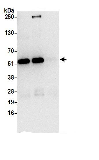 Immunoprecipitation:SHMT2 AntibodyNBP3-30303] -Detection of human SHMT2 by western blot of immunoprecipitates. Samples: Whole cell lysate (0.5 or 1.0 mg per IP reaction; 20% of IP loaded) from 293T cells prepared using NETN lysis buffer. Antibodies: Affinity purified rabbit anti-SHMT2 antibody NBP3-30303 (lot NBP3-30303-1) used for IP at 6 µg per reaction. SHMT2 was also immunoprecipitated by rabbit anti-SHMT2.. For blotting immunoprecipitated SHMT2, NBP3-30303 was used at 1 µg/ml. Detection: Chemiluminescence with an exposure time of 10 seconds.