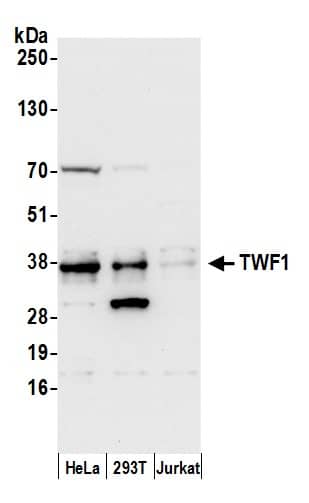 Western Blot:[NBP3-30311]-Detection of human TWF1 by western blot. Samples: Whole cell lysate from HeLa, HEK293T, and Jurkat cells prepared using NETN lysis buffer. Antibody: Affinity purified rabbit anti-TWF1 antibody used for WB at 0. 1 µg/ml. Detection: Chemiluminescence with an exposure time of 3 seconds.