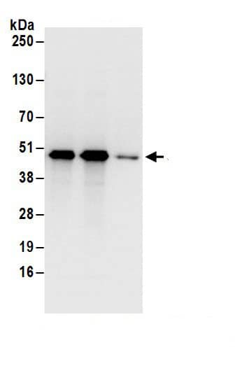 Immunoprecipitation:Septin-7 AntibodyNBP3-30316] -Detection of human Septin 7 by western blot of immunoprecipitates. Samples: Whole cell lysate (1 mg for IP; 20% of IP loaded) from HeLa cells. Antibodies: Affinity purified rabbit anti-Septin 7 antibody NBP3-30316 (lot NBP3-30316-1) used for IP at 6 µg/mg lysate. Septin 7 was also immunoprecipitated by rabbit anti-Septin 7.. For blotting immunoprecipitated Septin 7, NBP3-30316 was used at 1 µg/ml. Detection: Chemiluminescence with an exposure time of 1 second.