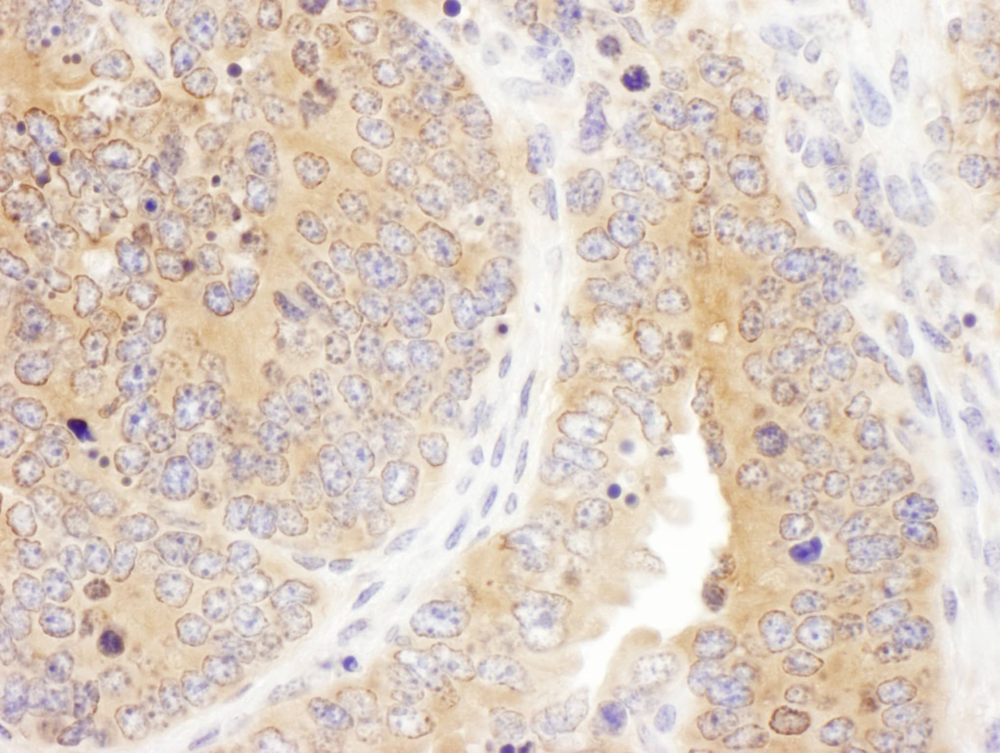 Immunohistochemistry Septin-7 Antibody - BSA Free
