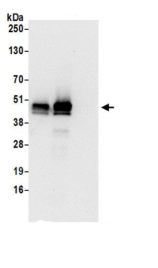 Immunoprecipitation:PDIA6 AntibodyNBP3-30317] -Detection of human ERp5 by western blot of immunoprecipitates. Samples: Whole cell lysate (0.5 or 1.0 mg per IP reaction; 20% of IP loaded) from 293T cells prepared using NETN lysis buffer. Antibodies: Affinity purified rabbit anti-ERp5 antibody NBP3-30317 (lot NBP3-30317-1) used for IP at 6 µg per reaction. ERp5 was also immunoprecipitated by rabbit anti-ERp5 antibody BL17102. For blotting immunoprecipitated ERp5, NBP3-30317 was used at 0.1 µg/ml. Detection: Chemiluminescence with an exposure time of 30 seconds.