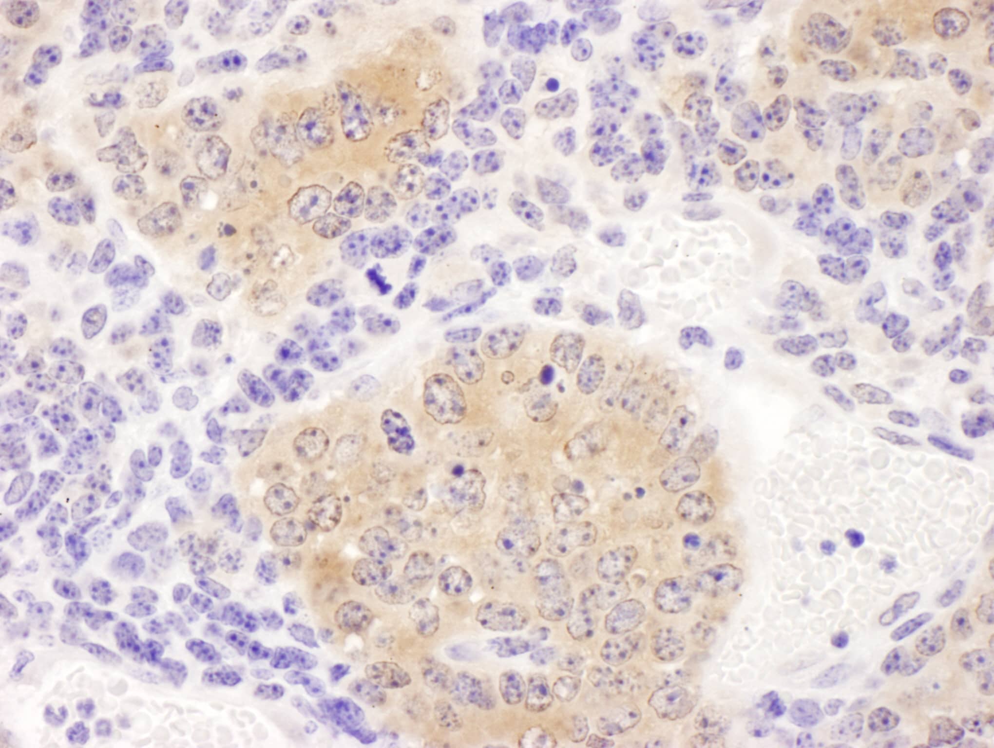Immunohistochemistry:[NBP3-30318]-Detection of mouse CCT8 by immunohistochemistry. Sample: FFPE section of mouse teratoma. Antibody: Affinity purified rabbit anti-CCT8 used at a dilution of 1: 200. Detection: DAB