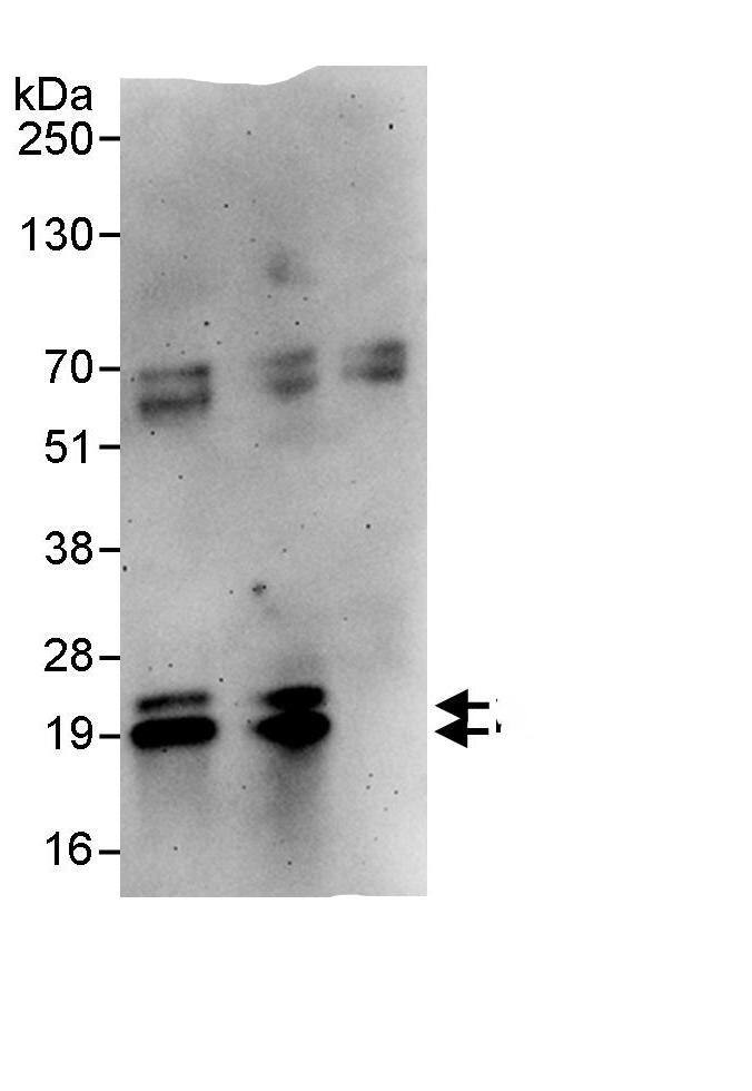 Immunoprecipitation:PPP1R14B AntibodyNBP3-30320] -Detection of human PPP1R14B by western blot of immunoprecipitates. Samples: Whole cell lysate (1 mg for IP, 20% of IP loaded) from HeLa cells. Antibodies: Affinity purified rabbit anti-PPP1R14B antibody NBP3-30320 used for IP at 10 µg/mg lysate. PPP1R14B was also immunoprecipitated by rabbit anti-PPP1R14B., which recognizes a downstream epitope. For blotting immunoprecipitated PPP1R14B,  was used at 1 µg/ml. Detection: Chemiluminescence with an exposure time of 3 minutes.