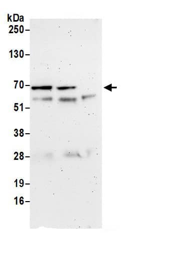 Immunoprecipitation:UBAP1 AntibodyNBP3-30321] -Detection of human UBAP1/NAG20 by western blot of immunoprecipitates. Samples: Whole cell lysate (0.5 or 1.0 mg per IP reaction; 20% of IP loaded) from 293T cells prepared using NETN lysis buffer. Antibodies: Affinity purified rabbit anti-UBAP1/NAG20 antibody NBP3-30321 (lot NBP3-30321-1) used for IP at 6 µg per reaction. UBAP1/NAG20 was also immunoprecipitated by rabbit anti-UBAP1/NAG20 antibody BL18890. For blotting immunoprecipitated UBAP1/NAG20, NBP3-30321 was used at 1 µg/ml. Detection: Chemiluminescence with an exposure time of 3 minutes.