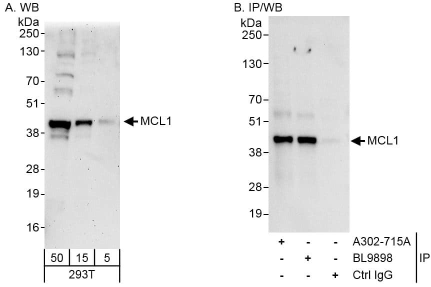 Western Blot:[NBP3-30322]-Detection of human MCL1 by western blot and immunoprecipitation. Samples: Whole cell lysate from HEK293T cells. Antibodies: Affinity purified rabbit anti-MCL1 antibody used for WB at 0. 04 µg/ml and 1 µg/ml and used for IP at 3 µg/mg lysate. MCL1 was also immunoprecipitated by rabbit anti-MCL1 antibody BL9898, which recognizes a downstream epitope. Detection: Chemiluminescence with exposure times of 3 minutes and 3 seconds.