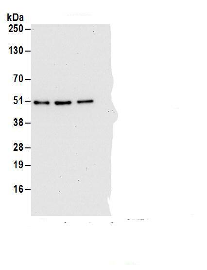 Immunoprecipitation:DAZAP1 AntibodyNBP3-30323] -Detection of human DAZAP1 by western blot of immunoprecipitates. Samples: Whole cell lysate (1 mg for IP; 20% of IP loaded) from HEK293T cells. Antibodies: Affinity purified rabbit anti-DAZAP1 antibody NBP3-30323 (lot NBP3-30323-1) used for IP at 6 µg/mg lysate. DAZAP1 was also immunoprecipitated by rabbit anti-DAZAP1 antibodies. For blotting immunoprecipitated DAZAP1, NBP3-30323 was used at 1 µg/ml. Detection: Chemiluminescence with an exposure time of 30 seconds.