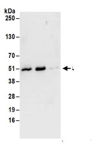 Immunoprecipitation:Septin-7 AntibodyNBP3-30324] -Detection of human Septin 7 by western blot of immunoprecipitates. Samples: Whole cell lysate (1 mg for IP; 20% of IP loaded) from HeLa cells. Antibodies: Affinity purified rabbit anti-Septin 7 antibody NBP3-30324 (lot NBP3-30324-1) used for IP at 6 µg/mg lysate. Septin 7 was also immunoprecipitated by rabbit anti-Septin 7.. For blotting immunoprecipitated Septin 7, NBP3-30324 was used at 1 µg/ml. Detection: Chemiluminescence with an exposure time of 10 seconds.