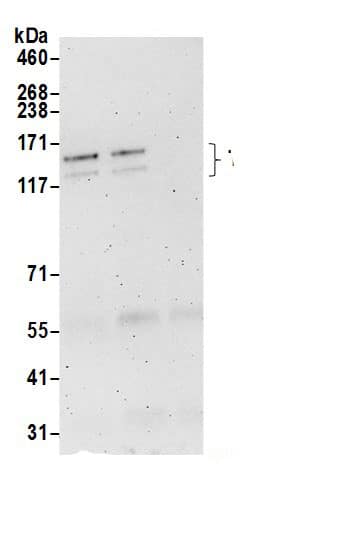 Immunoprecipitation:TBC1D1 AntibodyNBP3-30325] -Detection of human TBC1D1 by western blot of immunoprecipitates. Samples: Whole cell lysate (0.5 or 1.0 mg per IP reaction; 20% of IP loaded) from 293T cells prepared using NETN lysis buffer. Antibodies: Affinity purified rabbit anti-TBC1D1 antibody NBP3-30325 (lot NBP3-30325-1) used for IP at 6 µg per reaction. TBC1D1 was also immunoprecipitated by rabbit anti-TBC1D1.. For blotting immunoprecipitated TBC1D1, NBP3-30325 was used at 1 µg/ml. Detection: Chemiluminescence with an exposure time of 3 minutes.