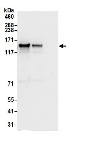 Immunoprecipitation:DIAPH3 AntibodyNBP3-30326] -Detection of human DIAPH3 by western blot of immunoprecipitates. Samples: Whole cell lysate (0.5 or 1.0 mg per IP reaction; 20% of IP loaded) from HeLa cells prepared using NETN lysis buffer. Antibodies: Affinity purified rabbit anti-DIAPH3 antibody NBP3-30326 (lot NBP3-30326-1) used for IP at 6 µg per reaction. DIAPH3 was also immunoprecipitated by rabbit anti-DIAPH3.. For blotting immunoprecipitated DIAPH3, NBP3-30326 was used at 1 µg/ml. Detection: Chemiluminescence with an exposure time of 3 seconds.