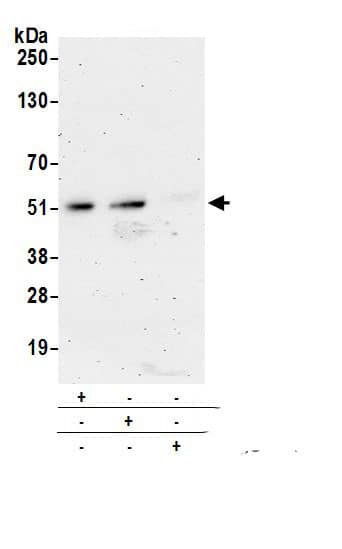 Immunoprecipitation:NADK AntibodyNBP3-30328] -Detection of human NADK by western blot of immunoprecipitates. Samples: Whole cell lysate (0.5 or 1.0 mg per IP reaction; 20% of IP loaded) from HeLa cells prepared using NETN lysis buffer. Antibodies: Affinity purified rabbit anti-NADK antibody NBP3-30328 (lot NBP3-30328-1) used for IP at 6 µg per reaction. NADK was also immunoprecipitated by rabbit anti-NADK antibody BL18989. For blotting immunoprecipitated NADK, NBP3-30328 was used at 1 µg/ml. Detection: Chemiluminescence with an exposure time of 3 minutes.