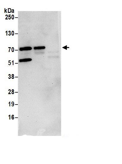 Immunoprecipitation:SLX4 Interacting Protein AntibodyNBP3-30329] -Detection of human SLX4IP/C20orf94 by western blot of immunoprecipitates. Samples: Whole cell lysate (0.5 or 1.0 mg per IP reaction; 20% of IP loaded) from 293T cells prepared using NETN lysis buffer. Antibodies: Affinity purified rabbit anti-SLX4IP/C20orf94 antibody NBP3-30329 (lot NBP3-30329-1) used for IP at 6 µg per reaction. SLX4IP/C20orf94 was also immunoprecipitated by rabbit anti-SLX4IP/C20orf94.. For blotting immunoprecipitated SLX4IP/C20orf94, NBP3-30329 was used at 1 µg/ml. Detection: Chemiluminescence with an exposure time of 30 seconds.