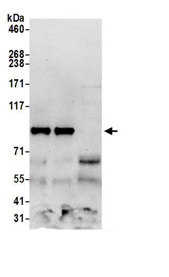 Immunoprecipitation:TSR1 AntibodyNBP3-30330] -Detection of human TSR1 by western blot of immunoprecipitates. Samples: Whole cell lysate (0.5 or 1.0 mg per IP reaction; 20% of IP loaded) from 293T cells prepared using NETN lysis buffer. Antibodies: Affinity purified rabbit anti-TSR1 antibody NBP3-30330 (lot NBP3-30330-1) used for IP at 6 µg per reaction. TSR1 was also immunoprecipitated by rabbit anti-TSR1.. For blotting immunoprecipitated TSR1, NBP3-30330 was used at 1 µg/ml. Detection: Chemiluminescence with an exposure time of 30 seconds.