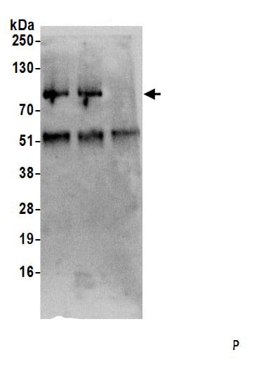 Immunoprecipitation:SFRS12 AntibodyNBP3-30331] -Detection of human SREK1 by western blot of immunoprecipitates. Samples: Whole cell lysate (0.5 or 1.0 mg per IP reaction; 20% of IP loaded) from HeLa cells prepared using NETN lysis buffer. Antibodies: Affinity purified rabbit anti-SREK1 antibody NBP3-30331 (lot NBP3-30331-1) used for IP at 6 µg per reaction. SREK1 was also immunoprecipitated by rabbit anti-SREK1.. For blotting immunoprecipitated SREK1, A305-105A was used at 1 µg/ml. Detection: Chemiluminescence with an exposure time of 30 seconds.