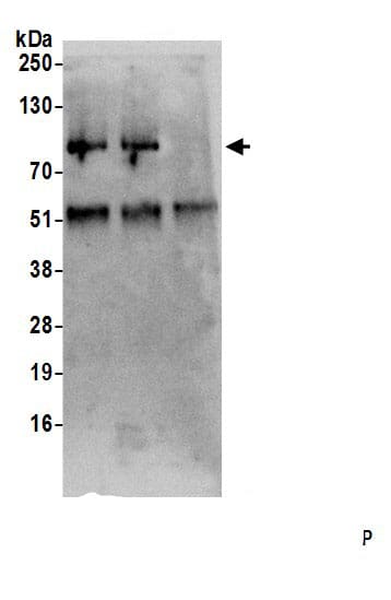Immunoprecipitation:SFRS12 AntibodyNBP3-30332] -Detection of human SREK1 by western blot of immunoprecipitates. Samples: Whole cell lysate (0.5 or 1.0 mg per IP reaction; 20% of IP loaded) from HeLa cells prepared using NETN lysis buffer. Antibodies: Affinity purified rabbit anti-SREK1 antibody NBP3-30332 (lot NBP3-30332-1) used for IP at 6 µg per reaction. SREK1 was also immunoprecipitated by rabbit anti-SREK1.. For blotting immunoprecipitated SREK1, NBP3-30332 was used at 1 µg/ml. Detection: Chemiluminescence with an exposure time of 30 seconds.