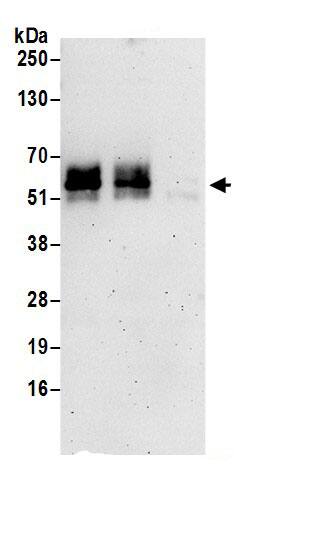 Immunoprecipitation:KCNK5 AntibodyNBP3-30333] -Detection of human TASK-2 by western blot of immunoprecipitates. Samples: Whole cell lysate (1 mg for IP; 20% of IP loaded) prepared using NETN buffer from HeLa cells. Antibodies: Affinity purified rabbit anti-TASK-2 antibody NBP3-30333 (lot NBP3-30333-1) used for IP at 6 µg per reaction. TASK-2 was also immunoprecipitated by rabbit anti-TASK-2.. For blotting immunoprecipitated TASK-2, NBP3-30333 was used at 1 µg/ml. Detection: Chemiluminescence with an exposure time of 3 minutes.