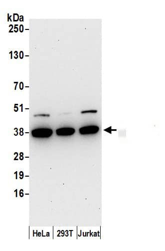 Western Blot:[NBP3-30334]-Detection of human AKR1B1 by western blot. Samples: Whole cell lysate from HeLa, HEK293T, and Jurkat cells prepared using NETN lysis buffer. Antibody: Affinity purified rabbit anti-AKR1B1 antibody used for WB at 0. 1 µg/ml. Detection: Chemiluminescence with an exposure time of 30 seconds.