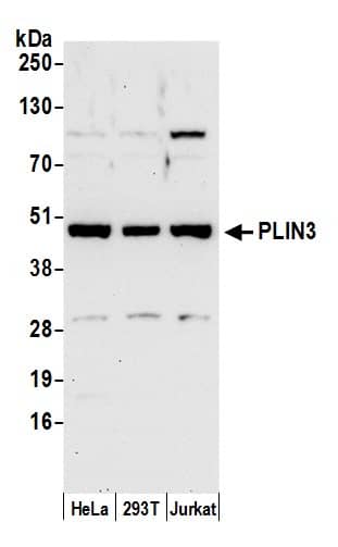 Western Blot:[NBP3-30335]-Detection of human PLIN3 by western blot. Samples: Whole cell lysate from HeLa, HEK293T, and Jurkat cells prepared using NETN lysis buffer. Antibody: Affinity purified rabbit anti-PLIN3 antibody used for WB at 0. 1 µg/ml. Detection: Chemiluminescence with an exposure time of 30 seconds.