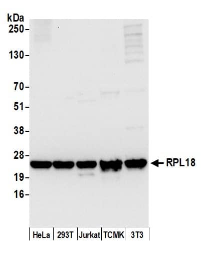 Western Blot:[NBP3-30336]-Detection of human and mouse RPL18 by western blot. Samples: Whole cell lysate from HeLa, HEK293T, Jurkat, mouse TCMK-1, and mouse NIH 3T3 cells prepared using NETN lysis buffer. Antibody: Affinity purified rabbit anti-RPL18 antibody used for WB at 0. 1 µg/ml. Detection: Chemiluminescence with an exposure time of 3 seconds.