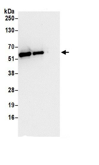 Immunoprecipitation:GRASP55 AntibodyNBP3-30340] -Detection of human GRASP55 by western blot of immunoprecipitates. Samples: Whole cell lysate (0.5 or 1.0 mg per IP reaction; 20% of IP loaded) from 293T cells prepared using NETN lysis buffer. Antibodies: Affinity purified rabbit anti-GRASP55 antibody NBP3-30340 (lot NBP3-30340-1) used for IP at 6 µg per reaction. GRASP55 was also immunoprecipitated by rabbit anti-GRASP55 antibody BL17153. For blotting immunoprecipitated GRASP55, NBP3-30340 was used at 1 µg/ml. Detection: Chemiluminescence with an exposure time of 30 seconds.