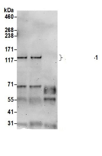 Immunoprecipitation:HA-1 AntibodyNBP3-30343] -Detection of human HMHA1/HA-1 by western blot of immunoprecipitates. Samples: Whole cell lysate (0.5 or 1.0 mg per IP reaction; 20% of IP loaded) from Jurkat cells prepared using NETN lysis buffer. Antibodies: Affinity purified rabbit anti-HMHA1/HA-1 antibody NBP3-30343 (lot NBP3-30343-1) used for IP at 6 µg per reaction. HMHA1/HA-1 was also immunoprecipitated by rabbit anti-HMHA1/HA-1.. For blotting immunoprecipitated HMHA1/HA-1, NBP3-30343 was used at 1 µg/ml. Detection: Chemiluminescence with an exposure time of 3 minutes.