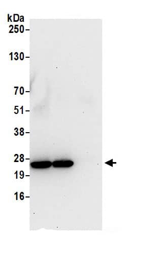 Immunoprecipitation:HSPC111 AntibodyNBP3-30345] -Detection of human NOP16 by western blot of immunoprecipitates. Samples: Whole cell lysate (0.5 or 1.0 mg per IP reaction; 20% of IP loaded) from HeLa cells prepared using NETN lysis buffer. Antibodies: Affinity purified rabbit anti-NOP16 antibody NBP3-30345 (lot NBP3-30345-1) used for IP at 6 µg per reaction. NOP16 was also immunoprecipitated by rabbit anti-NOP16.. For blotting immunoprecipitated NOP16, A305-125A was used at 0.4 µg/ml. Detection: Chemiluminescence with an exposure time of 30 seconds.