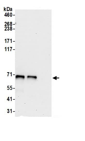 Immunoprecipitation:Acetyl CoA synthetase AntibodyNBP3-30346] -Detection of human ACSS2 by western blot of immunoprecipitates. Samples: Whole cell lysate (0.5 or 1.0 mg per IP reaction; 20% of IP loaded) from Hep-G2 cells prepared using NETN lysis buffer. Antibodies: Affinity purified rabbit anti-ACSS2 antibody NBP3-30346 (lot NBP3-30346-1) used for IP at 6 µg per reaction. ACSS2 was also immunoprecipitated by rabbit anti-ACSS2.. For blotting immunoprecipitated ACSS2, NBP3-30346 was used at 1 µg/ml. Detection: Chemiluminescence with an exposure time of 30 seconds.