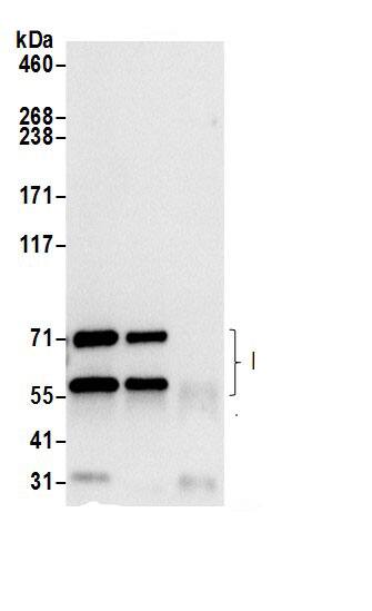 Immunoprecipitation:Prolyl Oligopeptidase/PREP AntibodyNBP3-30347] -Detection of human PREP by western blot of immunoprecipitates. Samples: Whole cell lysate (0.5 or 1.0 mg per IP reaction; 20% of IP loaded) from 293T cells prepared using NETN lysis buffer. Antibodies: Affinity purified rabbit anti-PREP antibody NBP3-30347 (lot NBP3-30347-1) used for IP at 6 µg per reaction. PREP was also immunoprecipitated by rabbit anti-PREP antibody. For blotting immunoprecipitated PREP, NBP3-30347 was used at 0.4 µg/ml. Detection: Chemiluminescence with an exposure time of 3 seconds.