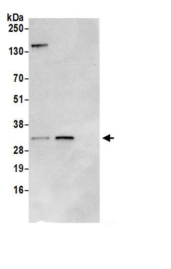 Immunoprecipitation:IMPA1 AntibodyNBP3-30348] -Detection of human IMPA1 by western blot of immunoprecipitates. Samples: Whole cell lysate (0.5 or 1.0 mg per IP reaction; 20% of IP loaded) from Jurkat cells prepared using NETN lysis buffer. Antibodies: Affinity purified rabbit anti-IMPA1 antibody NBP3-30348 (lot NBP3-30348-1) used for IP at 6 µg per reaction. IMPA1 was also immunoprecipitated by rabbit anti-IMPA1.. For blotting immunoprecipitated IMPA1, NBP3-30348 was used at 1 µg/ml. Detection: Chemiluminescence with an exposure time of 10 seconds.