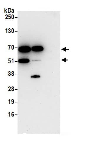 Immunoprecipitation:LMAN2 AntibodyNBP3-30349] -Detection of human LMAN2 by western blot of immunoprecipitates. Samples: Whole cell lysate (0.5 or 1.0 mg per IP reaction; 20% of IP loaded) from 293T cells prepared using NETN lysis buffer. Antibodies: Affinity purified rabbit anti-LMAN2 antibody NBP3-30349 (lot NBP3-30349-1) used for IP at 6 µg per reaction. LMAN2 was also immunoprecipitated by rabbit anti-LMAN2 antibody BL21600. For blotting immunoprecipitated LMAN2, NBP3-30349 was used at 1 µg/ml. Detection: Chemiluminescence with an exposure time of 30 seconds.