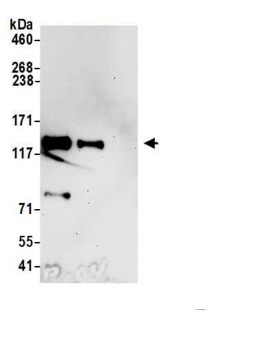 Immunoprecipitation:Palladin AntibodyNBP3-30351] -Detection of human Palladin by western blot of immunoprecipitates. Samples: Whole cell lysate (1.0 mg per IP reaction; 20% of IP loaded) from HeLa cells prepared using NETN lysis buffer. Antibodies: Affinity purified rabbit anti-Palladin antibody NBP3-30351 (lot NBP3-30351-1) used for IP at 6 µg per reaction. Palladin was also immunoprecipitated by rabbit anti-Palladin antibody . For blotting immunoprecipitated Palladin, NBP3-30351 was used at 0.04 µg/ml. Detection: Chemiluminescence with an exposure time of 30 seconds.