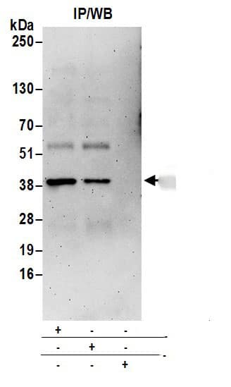 Immunoprecipitation:[NBP3-30352]-Detection of human BLVRA by western blot of immunoprecipitates. Samples: Whole cell lysate from 293T cells prepared using NETN lysis buffer. Antibodies: Affinity purified rabbit antibody used for IP at 6 µg per reaction. BLVRA was also immunoprecipitated by rabbit antibody. For blotting immunoprecipitated BLVRA, was used at 1 µg/ml. Detection: Chemiluminescence with an exposure time of 3 minutes.