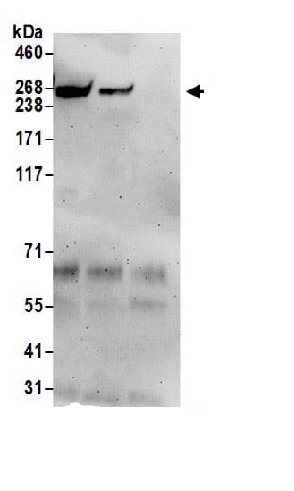 Immunoprecipitation:DNAJC13 AntibodyNBP3-30353] -Detection of human DNAJC13 by western blot of immunoprecipitates. Samples: Whole cell lysate (0.5 or 1.0 mg per IP reaction; 20% of IP loaded) from HeLa cells prepared using NETN lysis buffer. Antibodies: Affinity purified rabbit anti-DNAJC13 antibody NBP3-30353 (lot NBP3-30353-1) used for IP at 6 µg per reaction. DNAJC13 was also immunoprecipitated by rabbit anti-DNAJC13 antibody. For blotting immunoprecipitated DNAJC13, NBP3-30353 was used at 1 µg/ml. Detection: Chemiluminescence with an exposure time of 3 minutes.