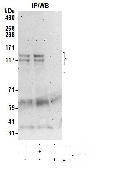 Immunoprecipitation:[NBP3-30355]-Detection of human Codanin 1/CDAN1 by western blot of immunoprecipitates. Samples: Whole cell lysate from 293T cells prepared using NETN lysis buffer. Antibodies: Affinity purified rabbit anti-Codanin 1/CDAN1 antibody used for IP at 6 µg per reaction. Codanin 1/CDAN1 was also immunoprecipitated by rabbit anti-Codanin 1/CDAN1 antibody. For blotting immunoprecipitated Codanin 1/CDAN1, was used at 1 µg/ml. Detection: Chemiluminescence with an exposure time of 3 minutes.