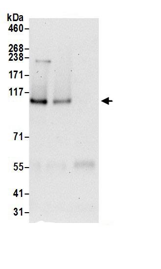 Immunoprecipitation:SRBD1 AntibodyNBP3-30356] -Detection of human SRBD1 by western blot of immunoprecipitates. Samples: Whole cell lysate (0.5 or 1.0 mg per IP reaction; 20% of IP loaded) from 293T cells prepared using NETN lysis buffer. Antibodies: Affinity purified rabbit anti-SRBD1 antibody NBP3-30356 (lot NBP3-30356-1) used for IP at 6 µg per reaction. SRBD1 was also immunoprecipitated by rabbit anti-SRBD1 antibody BL20191. For blotting immunoprecipitated SRBD1, NBP3-30356 was used at 1 µg/ml. Detection: Chemiluminescence with an exposure time of 30 seconds.