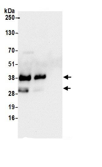 Immunoprecipitation:SCD-1 AntibodyNBP3-30358] -Detection of human SCD by western blot of immunoprecipitates. Samples: Whole cell lysate (0.5 or 1.0 mg per IP reaction; 20% of IP loaded) from HeLa cells prepared using NETN lysis buffer. Antibodies: Affinity purified rabbit anti-SCD antibody NBP3-30358 (lot NBP3-30358-1) used for IP at 6 µg per reaction. SCD was also immunoprecipitated by rabbit anti-SCD antibody BL20695. For blotting immunoprecipitated SCD, NBP3-30358 was used at 0.4 µg/ml. Detection: Chemiluminescence with an exposure time of 10 seconds.