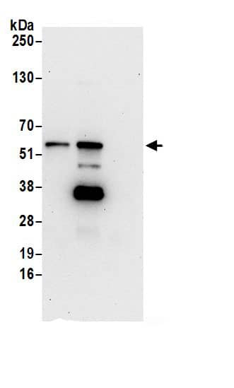 Immunoprecipitation:DNA Primase large subunit AntibodyNBP3-30359] -Detection of human PRIM2 by western blot of immunoprecipitates. Samples: Whole cell lysate (0.5 or 1.0 mg per IP reaction; 20% of IP loaded) from 293T cells prepared using NETN lysis buffer. Antibodies: Affinity purified rabbit anti-PRIM2 antibody NBP3-30359 (lot NBP3-30359-1) used for IP at 6 µg per reaction. PRIM2 was also immunoprecipitated by rabbit anti-PRIM2 antibody BL20850. For blotting immunoprecipitated PRIM2, NBP3-30359 was used at 0.4 µg/ml. Detection: Chemiluminescence with an exposure time of 30 seconds.