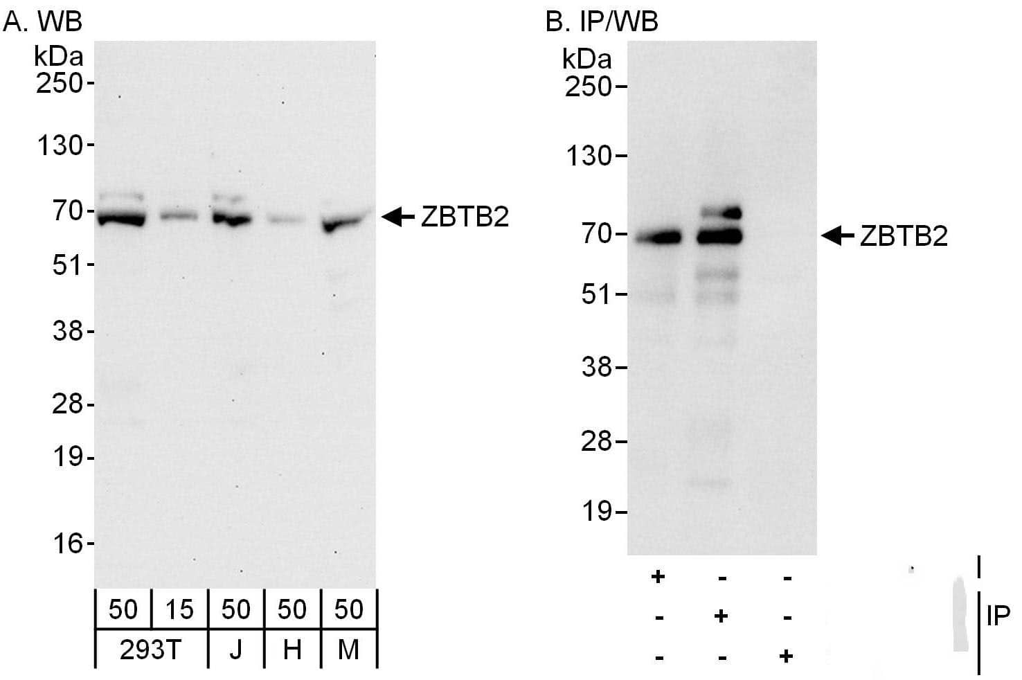 Western Blot:[NBP3-30361]-Detection of human and mouse ZBTB2 by western blot and immunoprecipitation. Samples: Whole cell lysate from HEK293T , Jurkat , HeLa and mouse NIH 3T3 cells. Antibodies: Affinity purified rabbit anti-ZBTB2 antibody used for WB at 0. 04 µg/ml and 1 µg/ml and used for IP at 6 µg/mg lysate. ZBTB2 was also immunoprecipitated by rabbit anti-ZBTB2 antibody , which recognizes an upstream epitope. Detection: Chemiluminescence with exposure times of 30 seconds and 10 seconds.