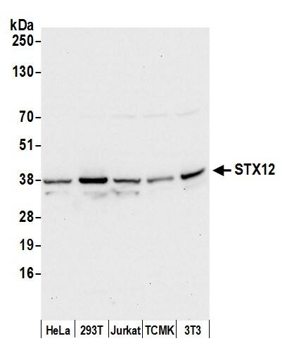 Western Blot:[NBP3-30362]-Detection of human and mouse STX12 by western blot. Samples: Whole cell lysate from HeLa, HEK293T, Jurkat, mouse TCMK-1, and mouse NIH 3T3 cells prepared using NETN lysis buffer. Antibody: Affinity purified rabbit anti-STX12 antibody used for WB at 0. 4 µg/ml. Detection: Chemiluminescence with an exposure time of 10 seconds.