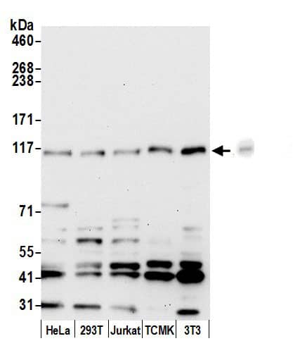 Western Blot ANKFY1 Antibody