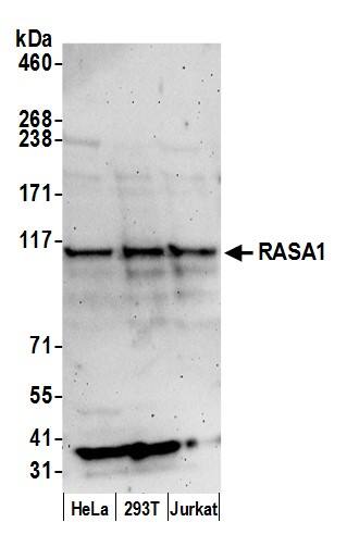 Western Blot:[NBP3-30365]-Detection of human RASA1 by western blot. Samples: Whole cell lysate from HeLa, HEK293T, and Jurkat cells prepared using NETN lysis buffer. Antibody: Affinity purified rabbit anti-RASA1 antibody used for WB at 0. 4 mg/ml. Detection: Chemiluminescence with an exposure time of 3 minutes.