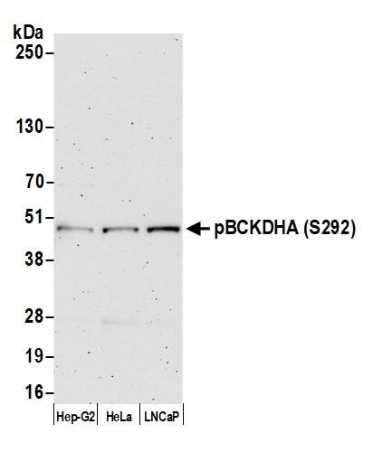 Western Blot:[NBP3-30366]-Detection of human pBCKDHA by western blot. Samples: Whole cell lysate from Hep-G2, HeLa, and LNCaP cells prepared using NETN lysis buffer. Antibody: Affinity purified rabbit antibody used for WB at 0. 04 µg/ml. Detection: Chemiluminescence with an exposure time of 3 minutes.