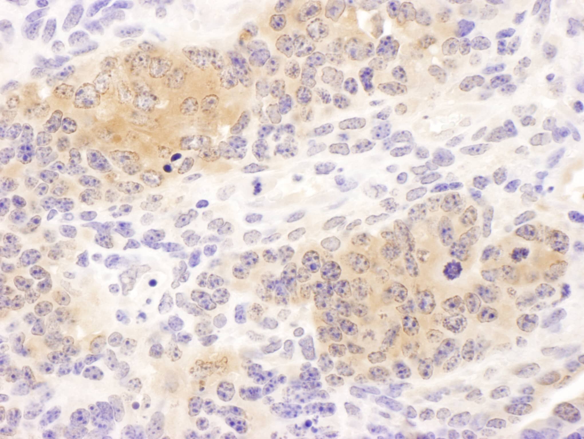 Immunohistochemistry:[NBP3-30369]-Detection of mouse CCT8 by immunohistochemistry. Sample: FFPE section of mouse teratoma. Antibody: Affinity purified rabbit anti-CCT8 used at a dilution of 1: 200. Detection: DAB